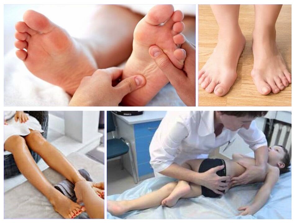 Valgo deformation in the treatment of children