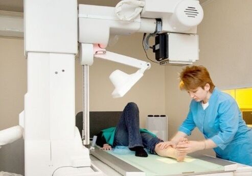 X -Rays legs